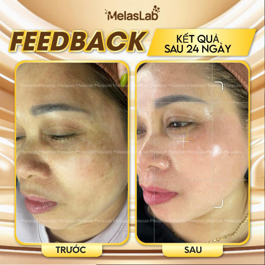 Feedback khách hàng 4